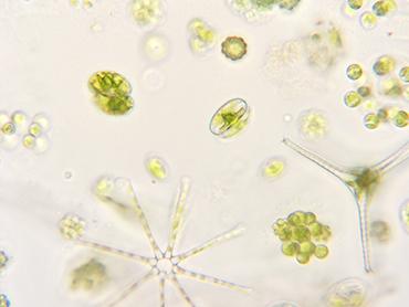 Lake algae under the microscope - high magnification