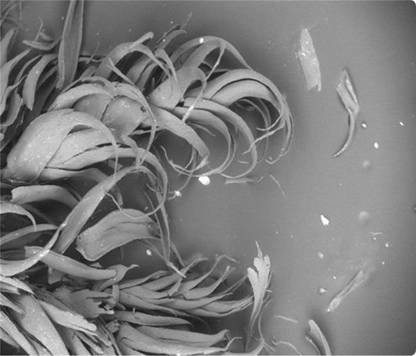 Microplastics in moss under microscope.