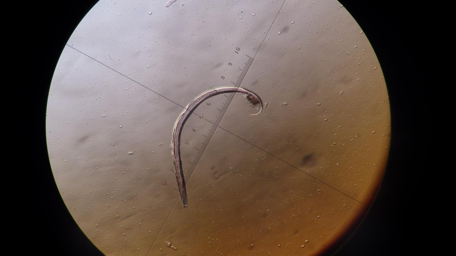 Plectus is a species of nematode (roundworm)