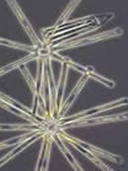 The freshwater diatom Asterionella formosa 